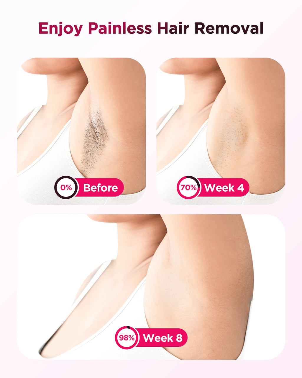 Depiladora Laser IPL 990,000 Flashes / Eliminacion de Vello Permanente, Rapida y Sin Dolor